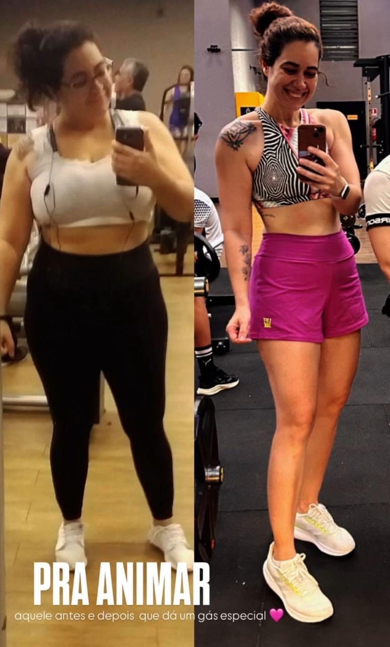 Antes e depois de emagrecimento — paciente da Clínica Evolux em Fortaleza