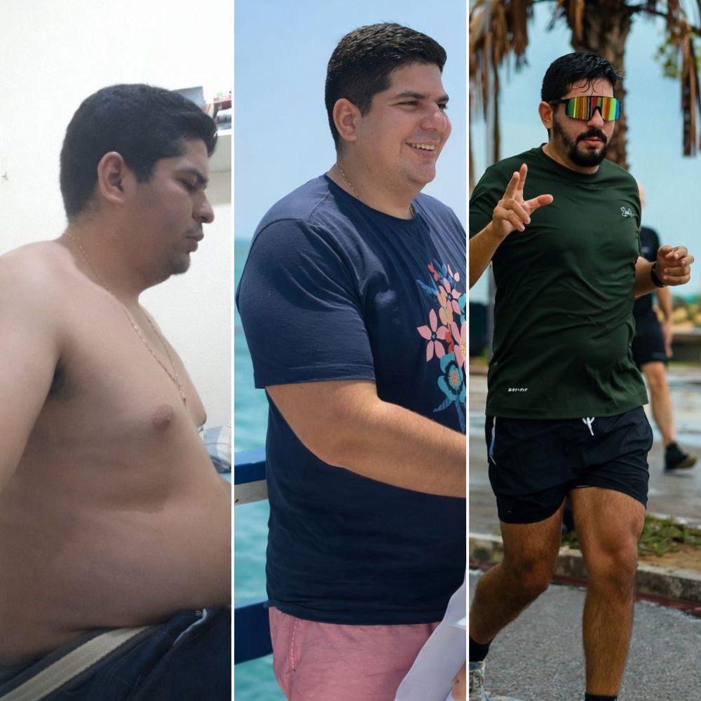 Evolução de emagrecimento com acompanhamento médico na Clínica Evolux